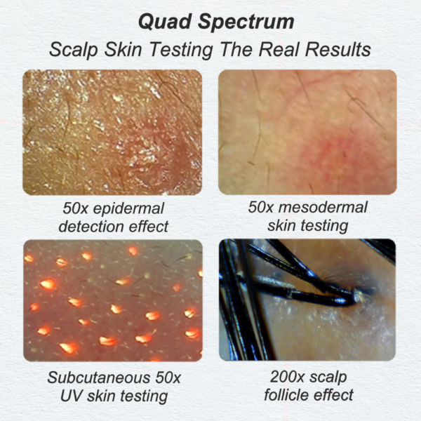 Scalp Detector