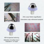 Scalp Detector