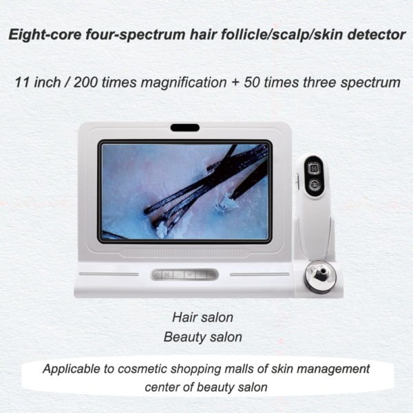 Scalp Detector